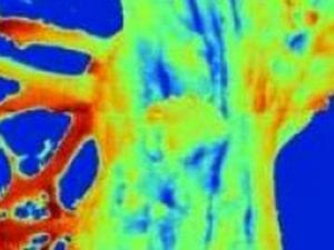 Advanced Thermal Tree Imaging